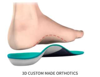 Graphic of foot over a 3D custom made orthotic sole