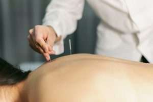 Get the Most Out of Your Acupuncture Treatment